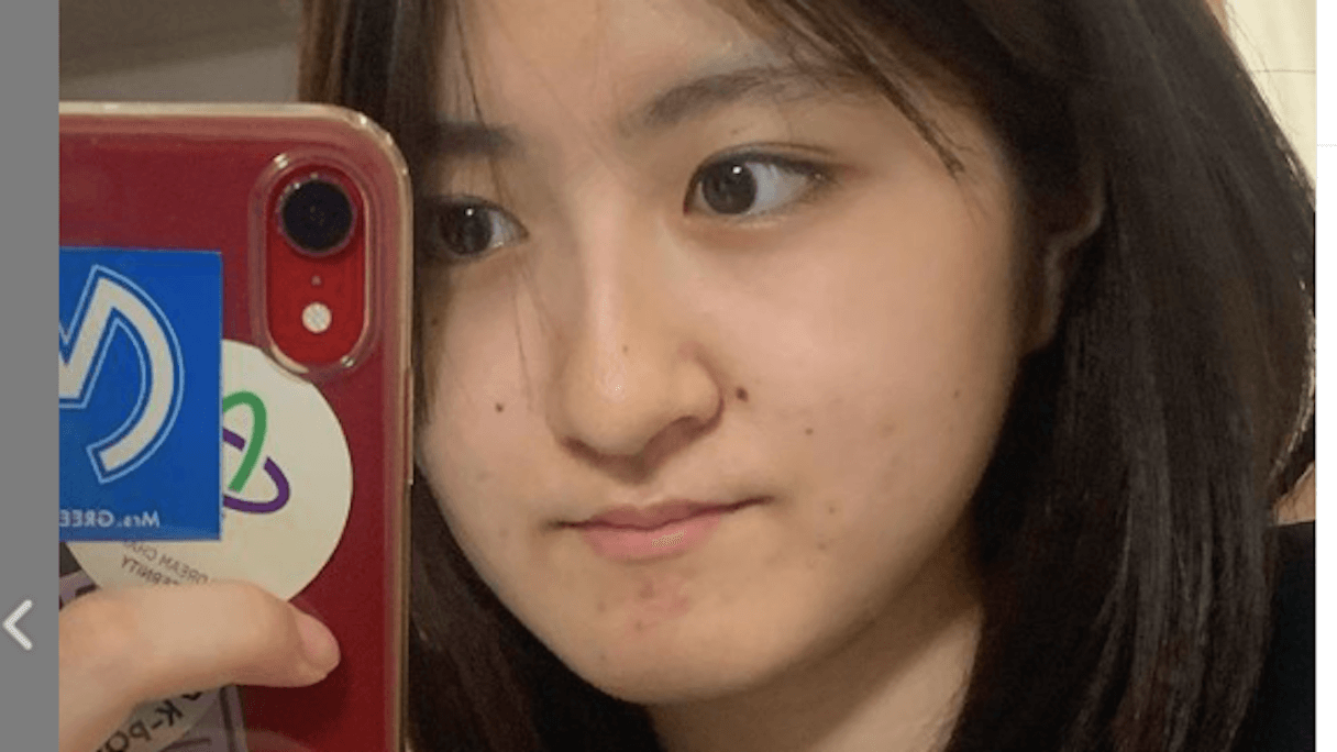 小林星蘭　エロ 有村藍里「整形をしたからって……」元子役・小林星蘭「“戒めの”すっぴん公開」！ 女性タレントの“外見”あれこれ(2021/05/20  14:28)｜サイゾーウーマン