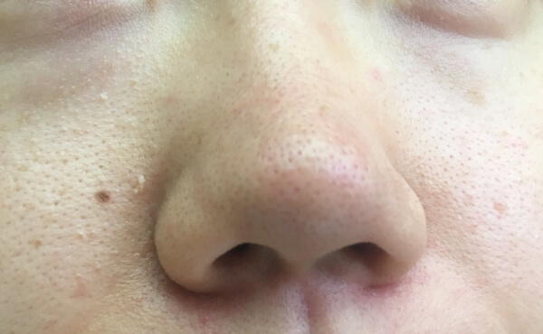 全体的に毛穴がしまった感じ（C）サイゾーウーマン