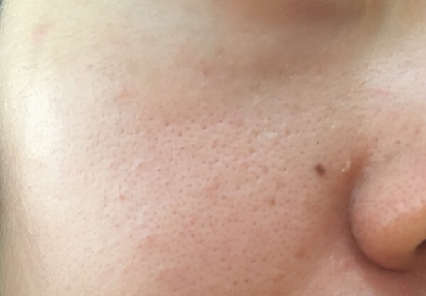 肌がトーンUP！毛穴も少なく！（C）サイゾーウーマン