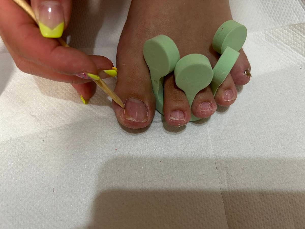 はみ出したジェルをウッドスティックで硬化前に除去する画像