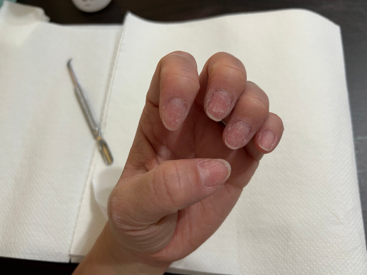 100均のリムーバーでジェルネイルをオフした画像