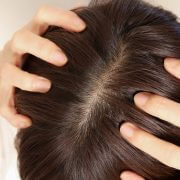 元美容師おすすめ【2,000円以下で買える育毛剤】は？　フィヨーレは「美容液のようなアイテム」